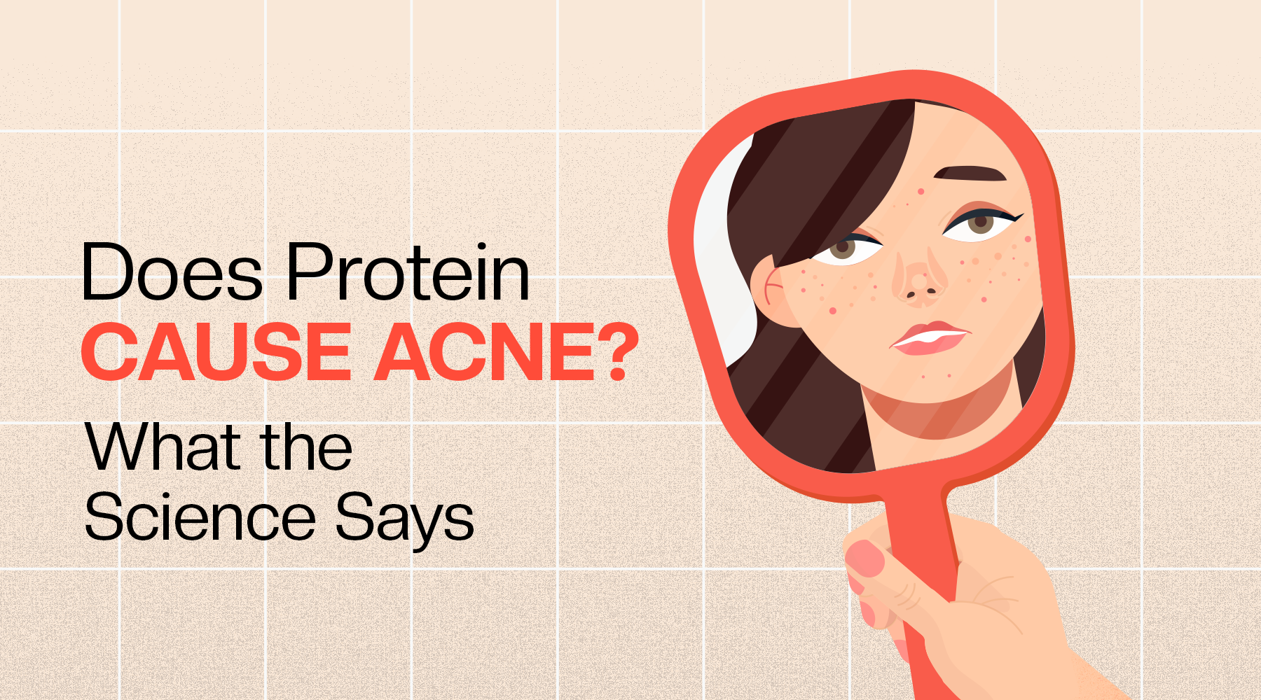 can l carnitine cause acne Antiacne activity of salicylate and magnolol through the regulation of exfoliation, lipogenesis, bacterial growth and inflammation - Kwon - 2023 - Skin Research and Technology Does Protein Cause Acne? What
